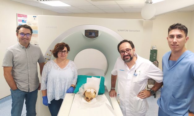 El Hospital Asepeyo de Sant Cugat colabora con la Universidad de Barcelona en una investigación prehistórica
